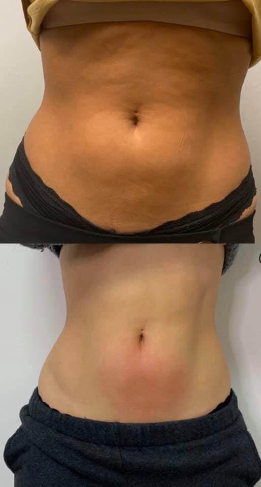 Cryo Lab Face + Body - Raleigh — recovery studio