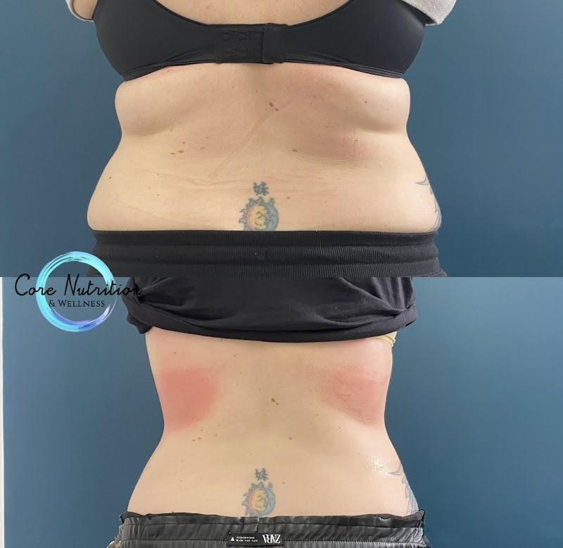 Beach Cities Cryo & Wellness — photo 2