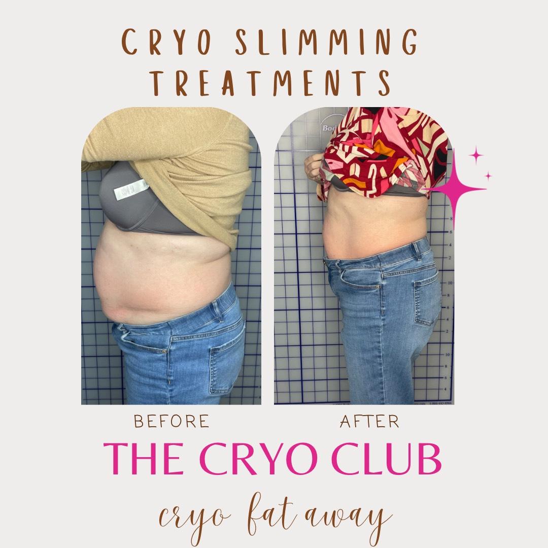 The Cryo Club — photo 3