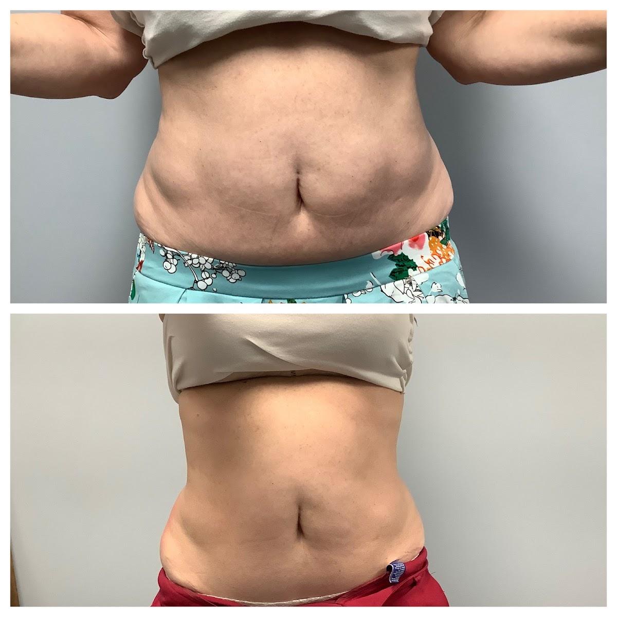 Cypress Cryotherapy — photo 3