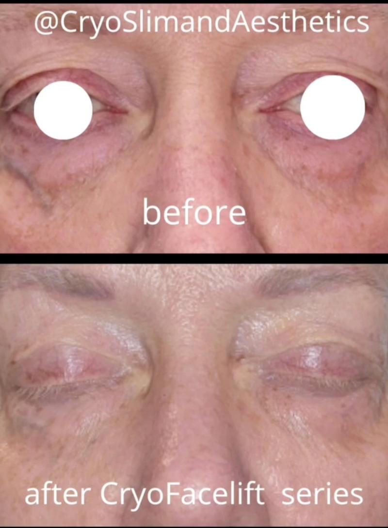 CryoSlim & Aesthetics — recovery studio in St Johns, FL
