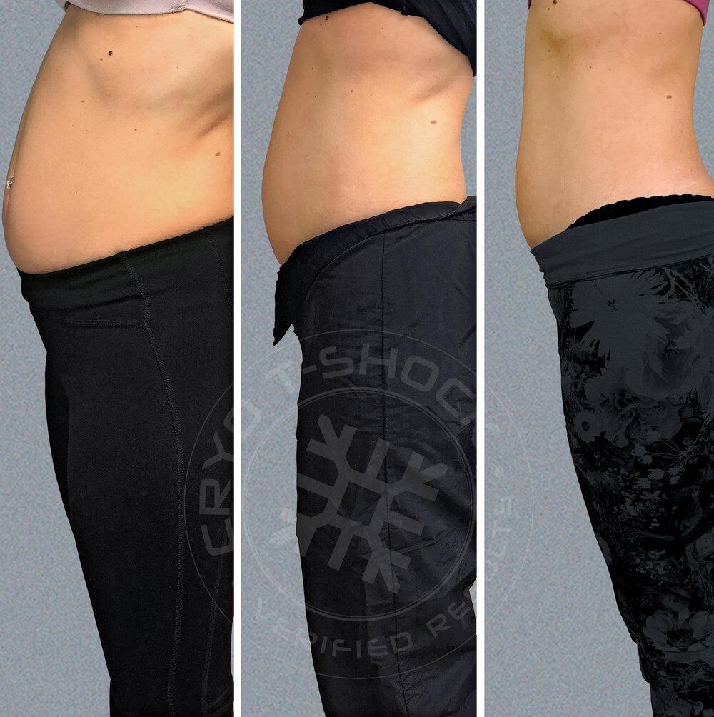 Cryo Boutique — photo 4