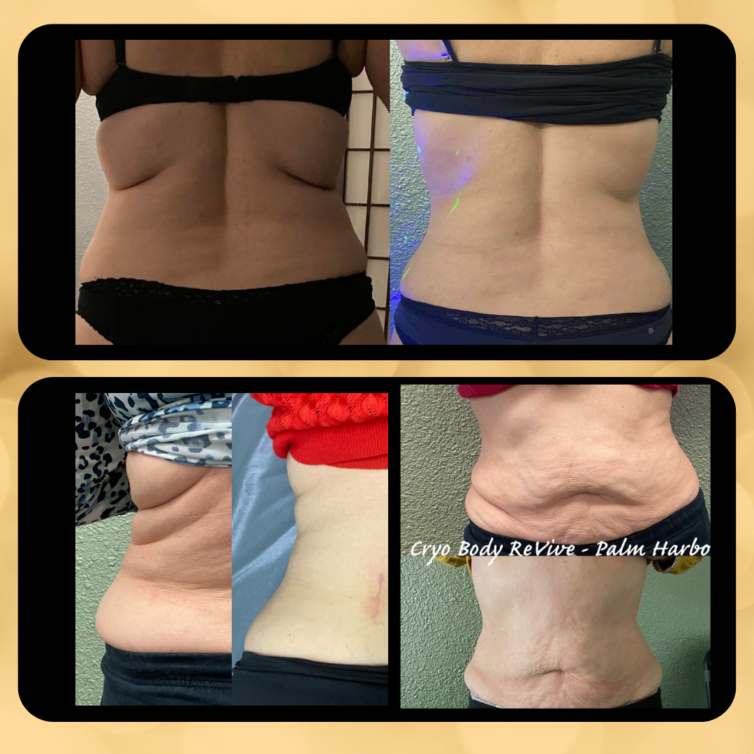 Cryo Body ReVive — photo 4