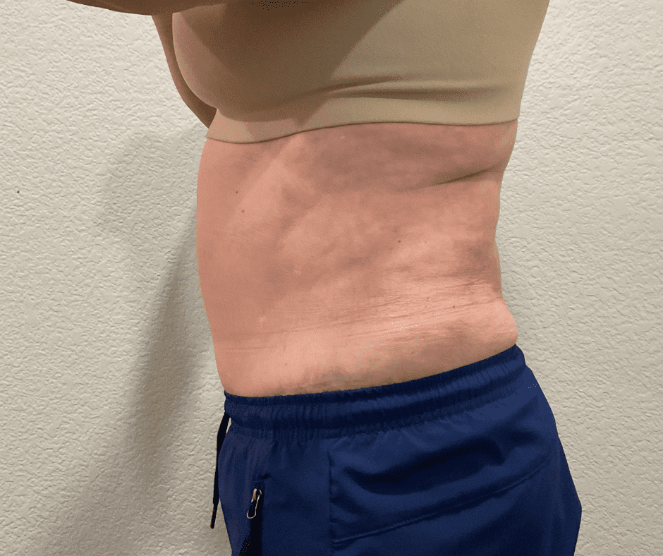 Body Haxx Cryo and Wellness — photo 2