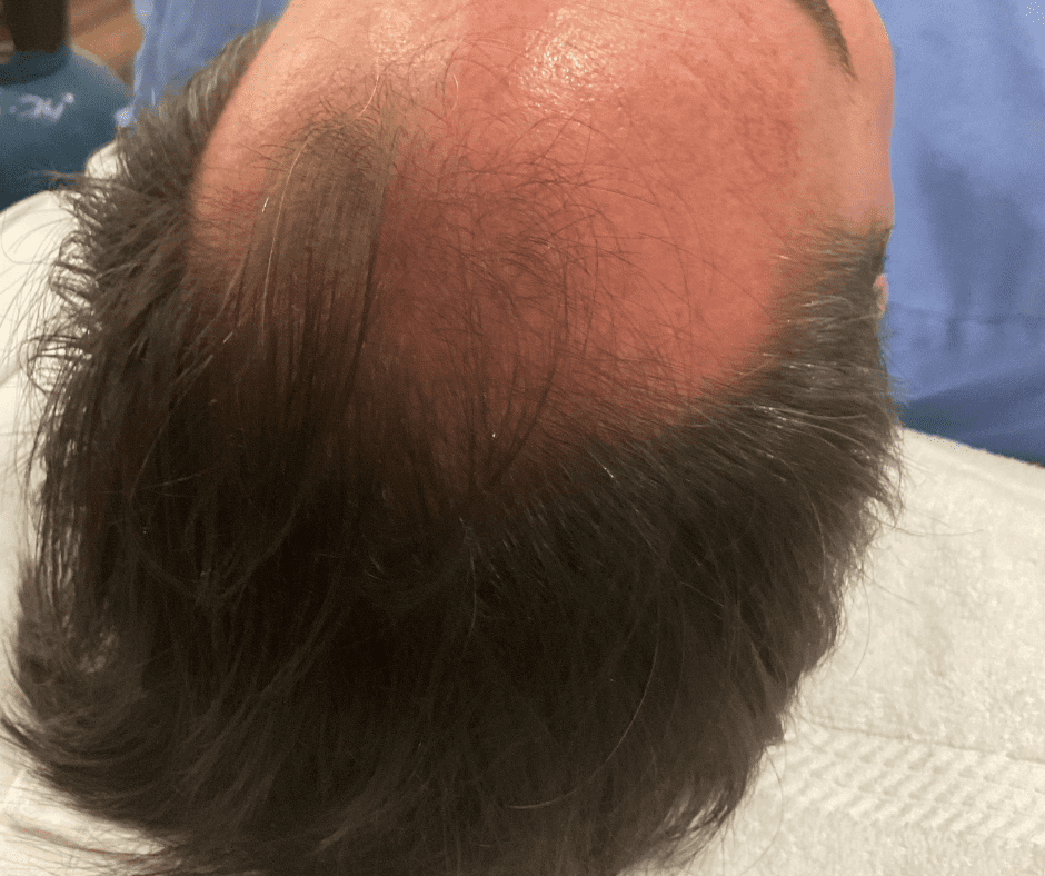 Body Haxx Cryo and Wellness — photo 3