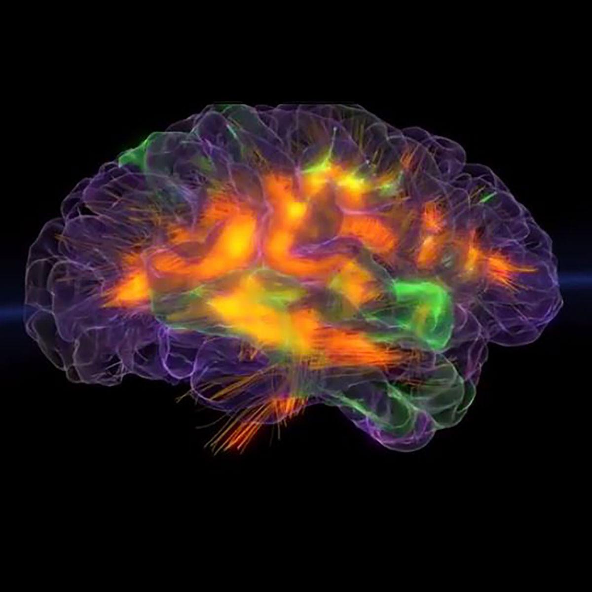 Neurofit — photo 2