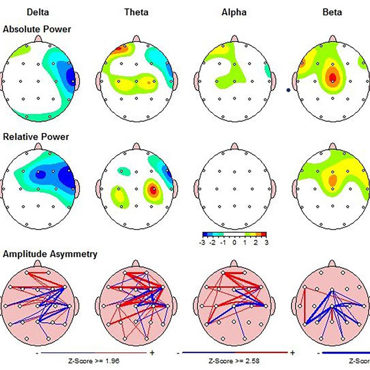 Neurofit — photo 3